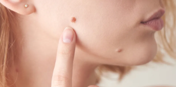 Memahami Hubungan Antara Kesehatan Sistemik dan Kondisi Kulit